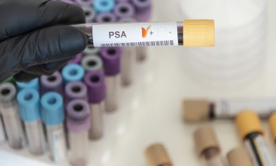 Urologista Goiânia - PSA substitui o exame de toque?