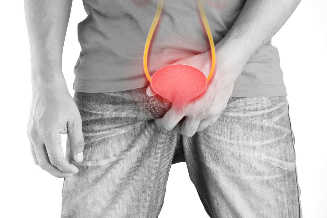 Urologista Goiânia - Quais os sintomas da estenose de uretra?