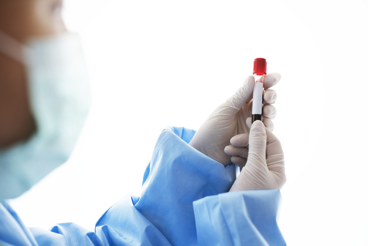 Urologia Goiânia - Você já fez exame de PSA?