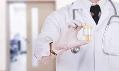 Urologista Goiânia - Sinais de alerta do câncer de bexiga 