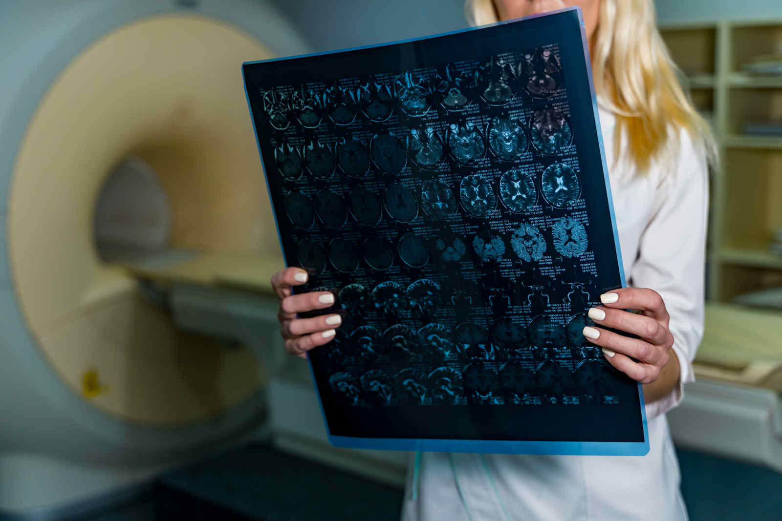 Centro de Imagem Aparecida de Goiânia - Tomografia de crânio no diagnóstico do AVC - acidente vascular cerebral 2