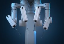 Cirurgia Robótica Goiânia -Quem faz a cirurgia robótica o médico ou o robô