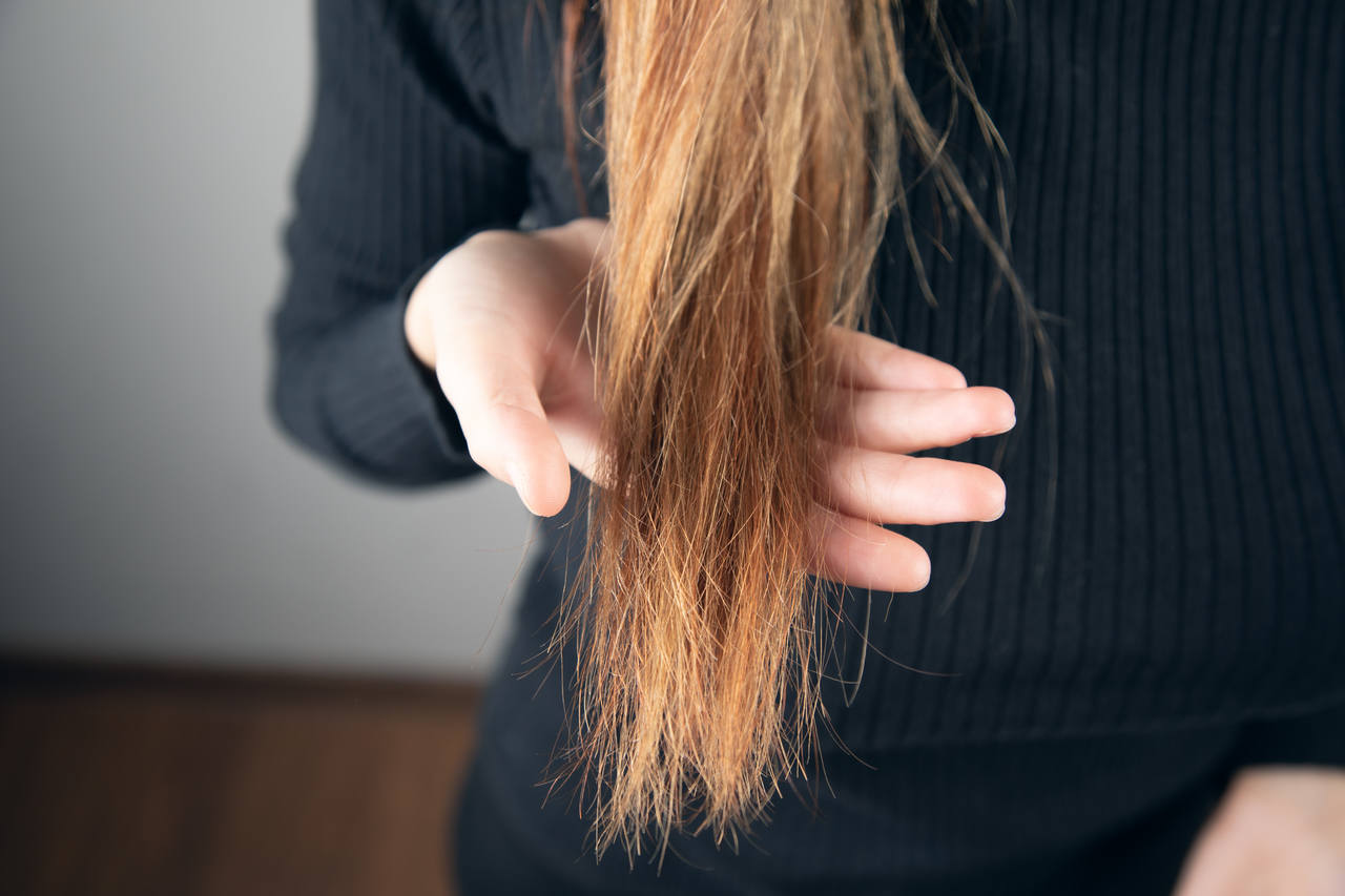 Especilaista em Doenças do cabelo Goiânia- O que é intemperismo capilar