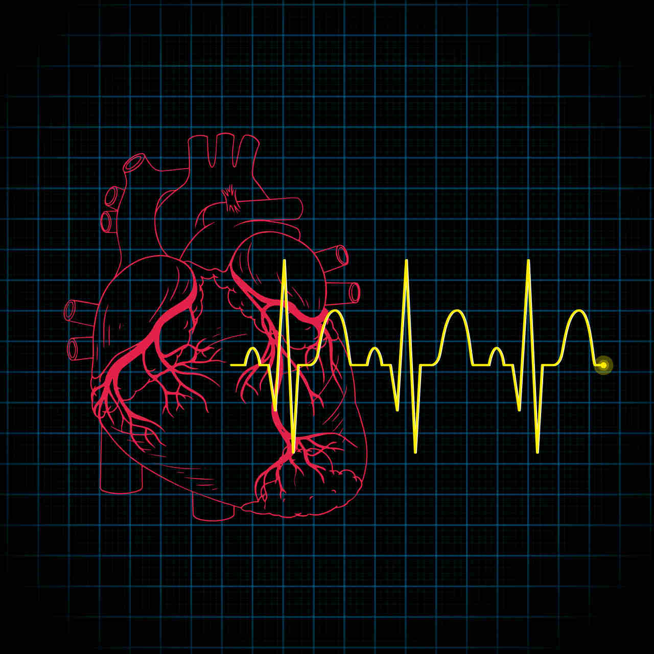 Centro de Imagem Aparecida de Goiânia - Eletrocardiograma: check up do coração e pré-operatório