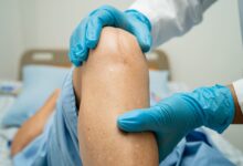 Clinica de Ortopedia Goiânia - Como é a recuperação da cirurgia de prótese de joelho?