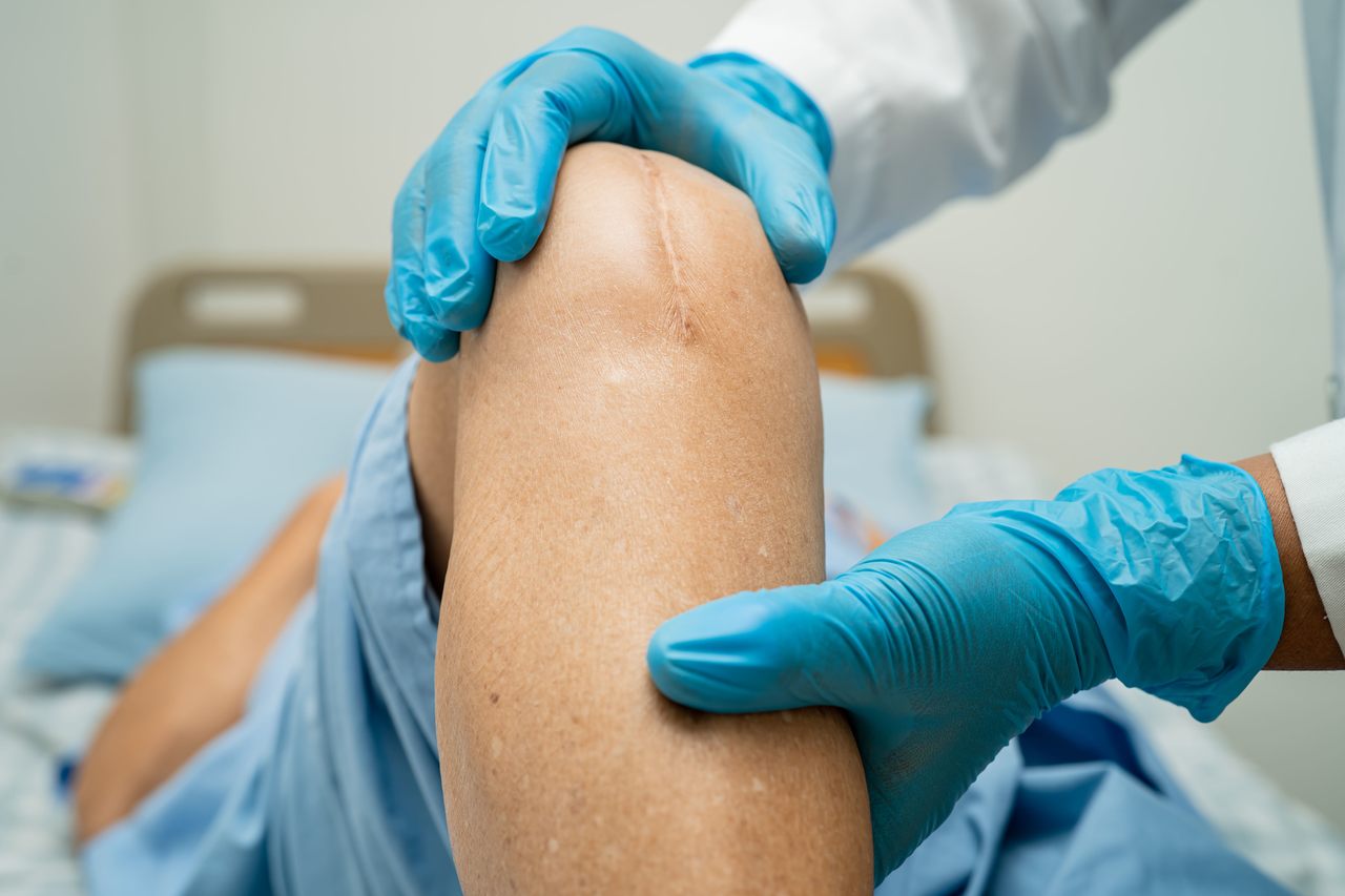 Clinica de Ortopedia Goiânia - Como é a recuperação da cirurgia de prótese de joelho?