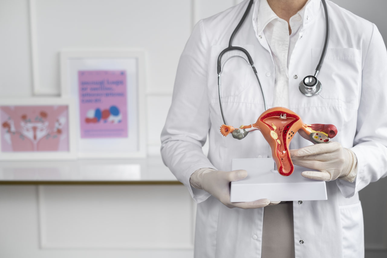Ginecologia Goiânia - Um alerta com carinho sobre Endometriose!