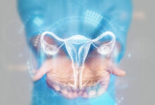 Centro de Imagem Aparecida de Goiânia - Importância da avaliação de cistos ovarianos com ultrassom