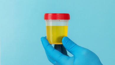 Clinica de Urologia Goiânia - Sabia que o sangue na urina está presente em 90% dos casos de câncer de bexiga