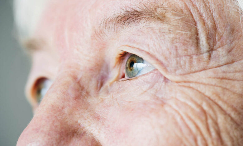 Oftalmologia Goiânia - Glaucoma: conheça os sintomas e saiba como prevenir
