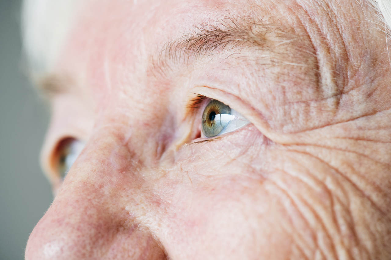 Oftalmologia Goiânia - Glaucoma: conheça os sintomas e saiba como prevenir