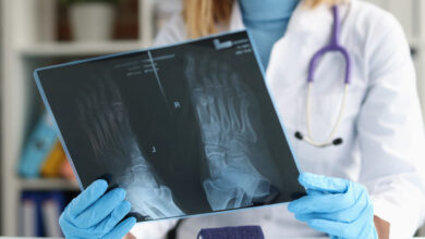Centro de Imagem Aparecida de Goiânia - Está com dor no pé? O raio x pode auxiliar no diagnóstico.