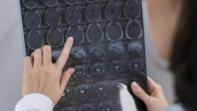 Centro de Imagem Aparecida de Goiânia - Importância da tomografia no tumor cerebral