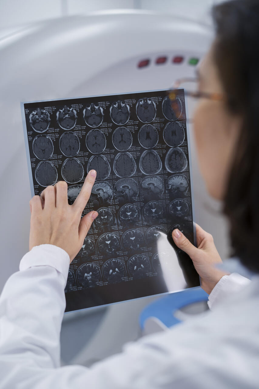 Centro de Imagem Aparecida de Goiânia - Importância da tomografia no tumor cerebral