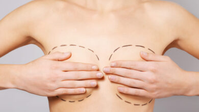 Cirurgia Plástica Goiânia - Conheça os tipos de mamoplastia