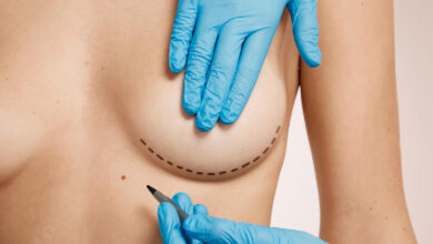 Cirurgia Plástica Goiânia - 4 principais opções de cirurgia plástica de mama