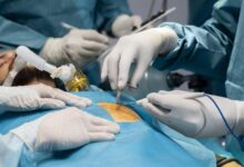 Jornal Opinião de Goiás - Saúde Hospital público de Rondônia fará transplante de tecido ósseo