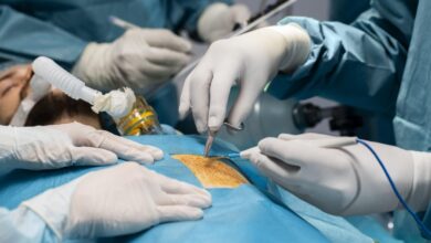Jornal Opinião de Goiás - Saúde Hospital público de Rondônia fará transplante de tecido ósseo