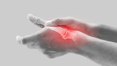 Ortopedia Goiânia - Artrose mais comum na mão rizartrose