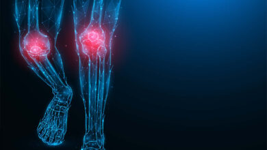Ortopedia Goiânia - Conheça as 8 lesões mais comuns no joelho