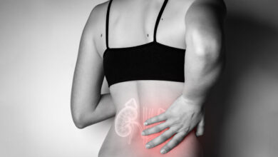 Urologia Goiânia - 5 sinais de pedra nos rins que você não deve ignorar!