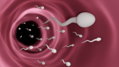 Urologia Goiânia - Relação da varicocele com a infertilidade
