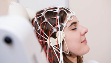 Centro de Imagem Aparecida de Goiânia - Eletroencefalograma (EEG): quando é indicado?