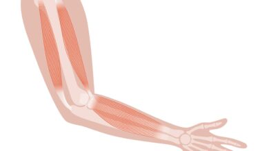 Ortopedia Goiânia - 5 sintomas de epicondilite lateral do cotovelo