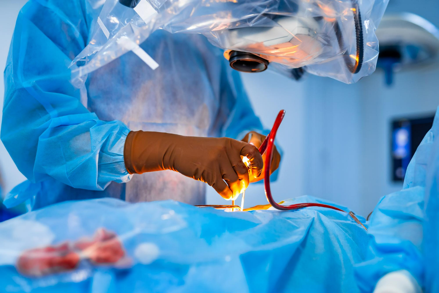 Cirurgia Plástica Goiânia - Qual a função do dreno na cirurgia plástica