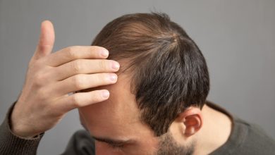 Hospital Aparecida de Goiânia - O que causa a alopecia?