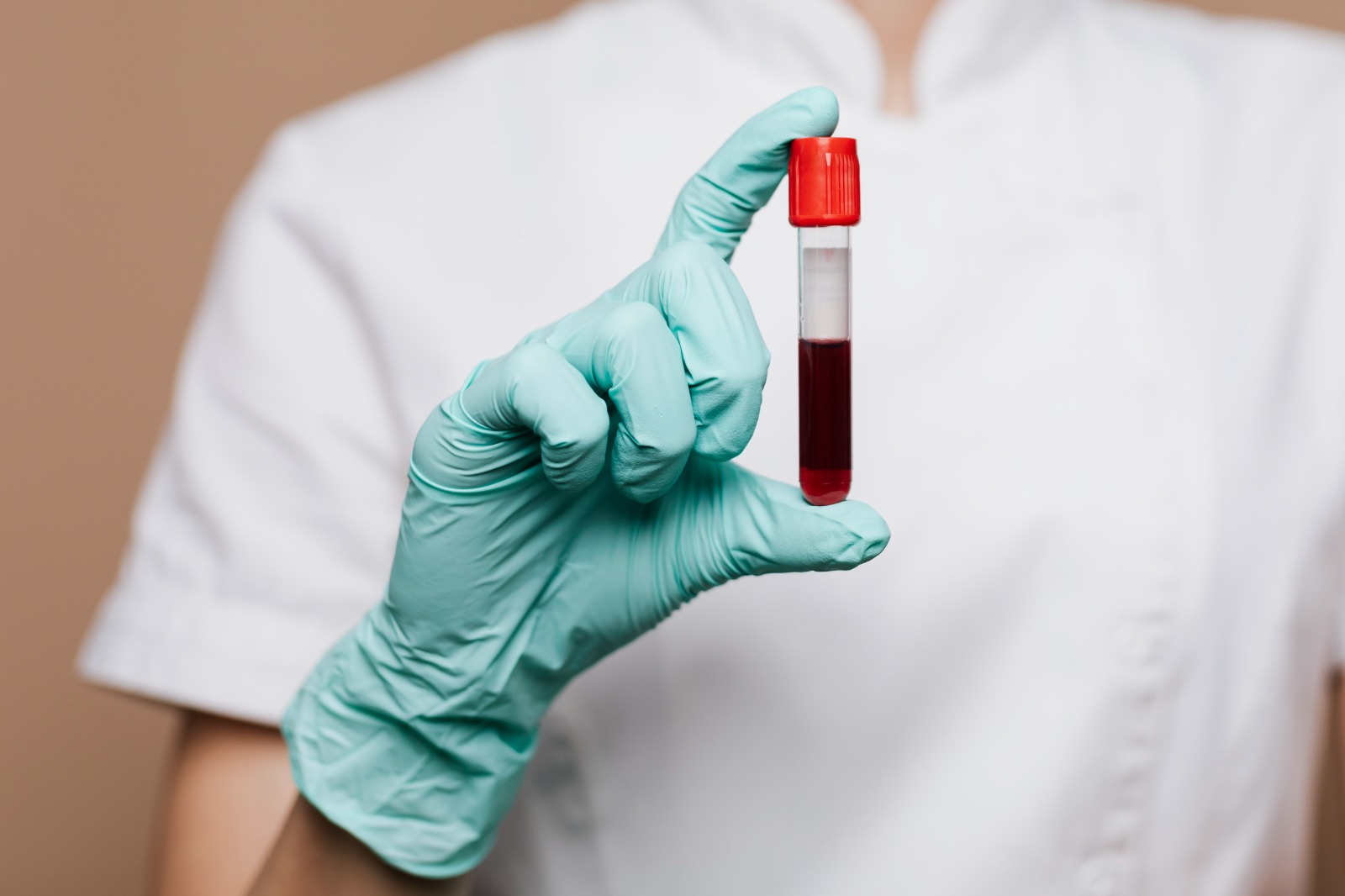 Descubra agora os 6 exames de sangue que detectam a inflamação!