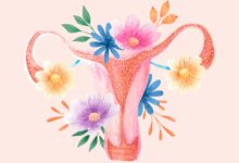 Endometriose: você conhece os sintomas?