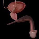 6-Holep-para-tratar-hiperplasia-de-prostata-pode-causar-impotencia