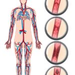 3 – Como a tecnologia Doppler Colorido é aplicada no diagnóstico de condições vasculares como trombose ou estenose