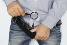 Você tem fimose Fique atento e saiba quando é preciso operar!