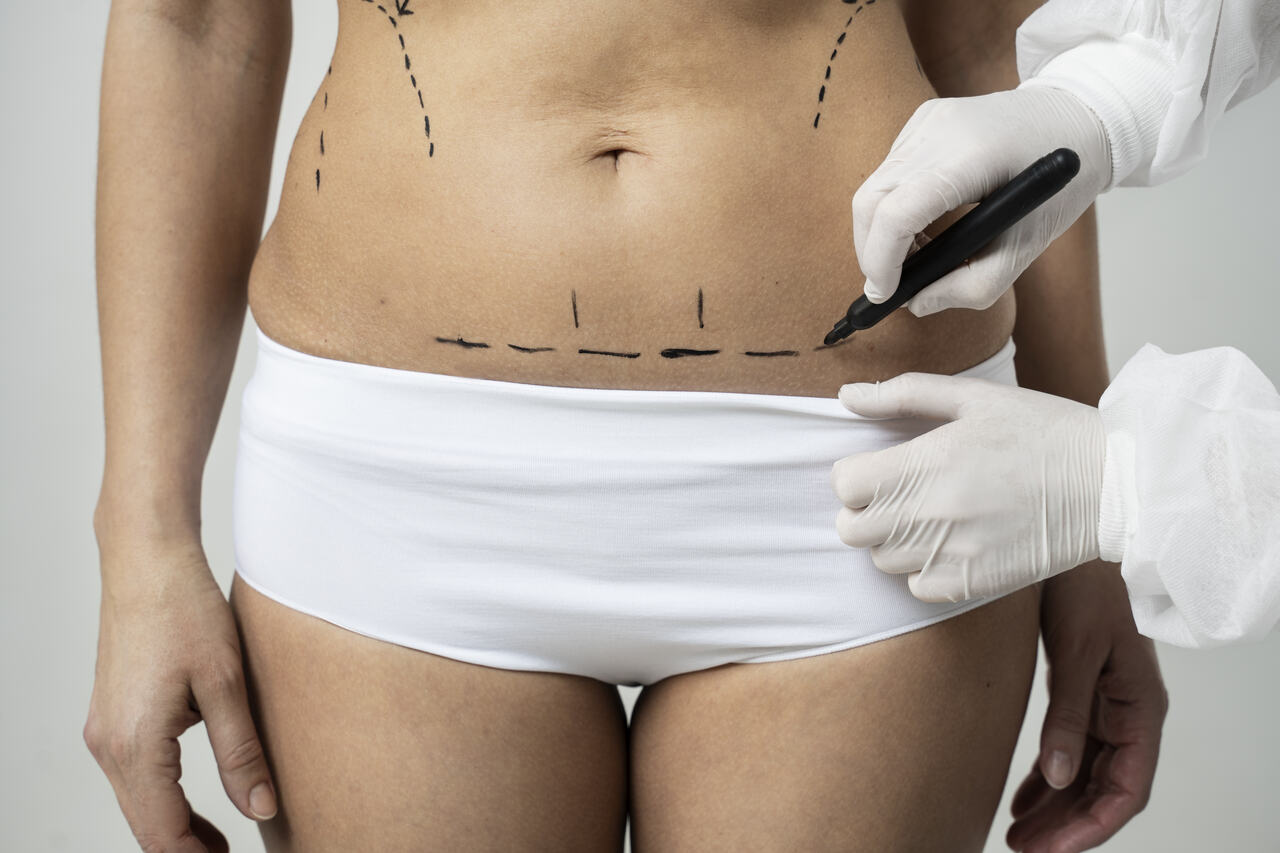 Cirurgião plástico Brasília: Como as cicatrizes evoluem ao longo do tempo e o que pode ser feito para minimizá-las?