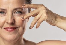 Quais são os benefícios estéticos e funcionais da blefaroplastia?