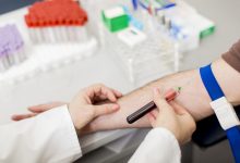 Exame de PSA - porque ele não substitui o exame de toque?