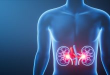 Fique atento a esses sinais! Pode ser câncer renal!