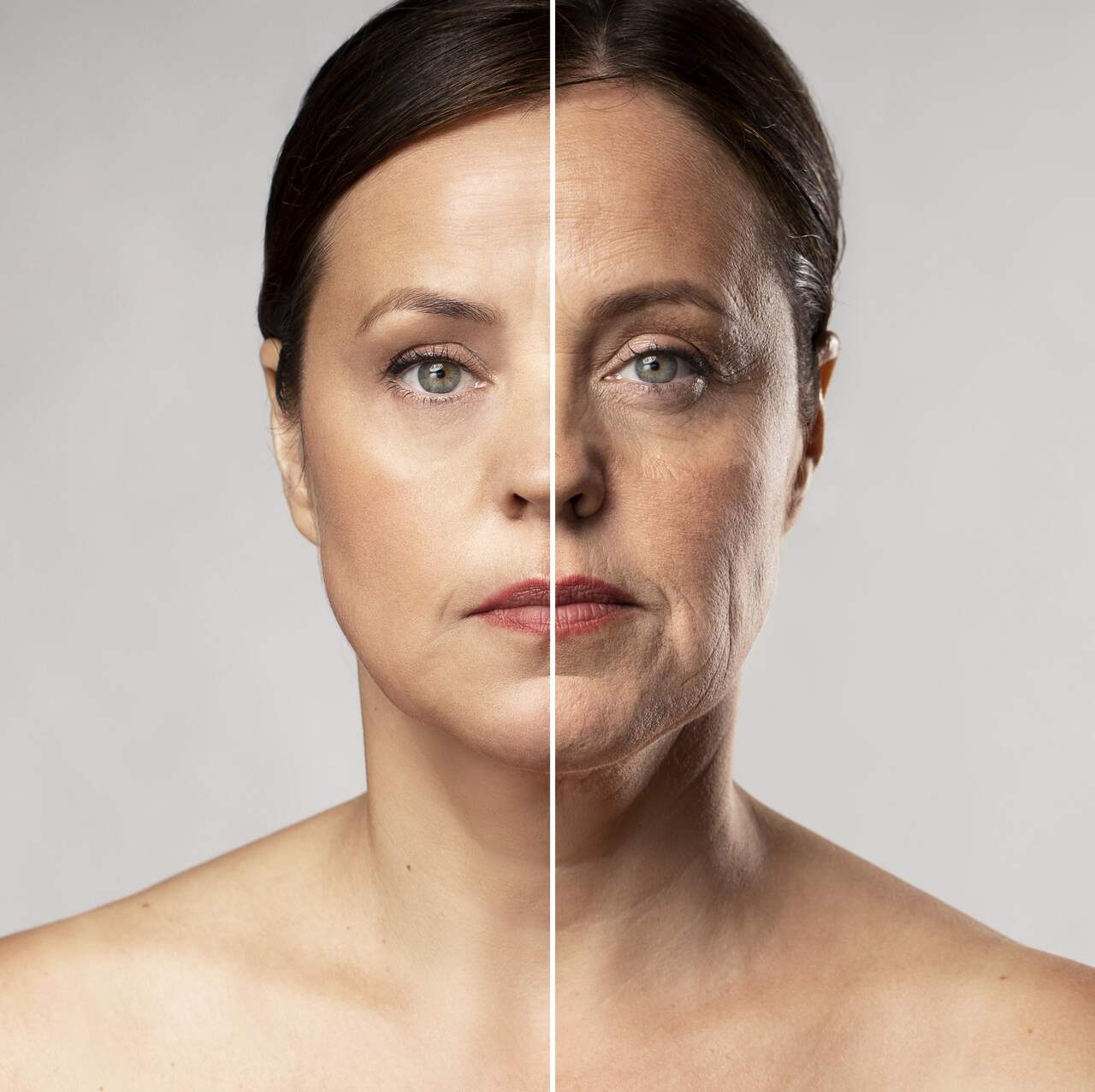 A flacidez facial tem impactado sua autoestima Descubra o poder do Lifting Facial!