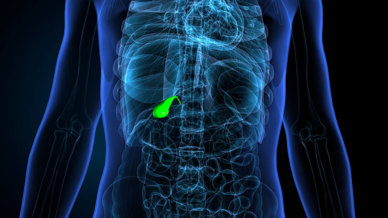 Pedras na vesícula quando a única solução é a cirurgia