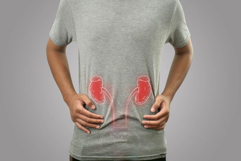 Urologista Goiânia – Pedra nos rins pode ser eliminada pela urina?