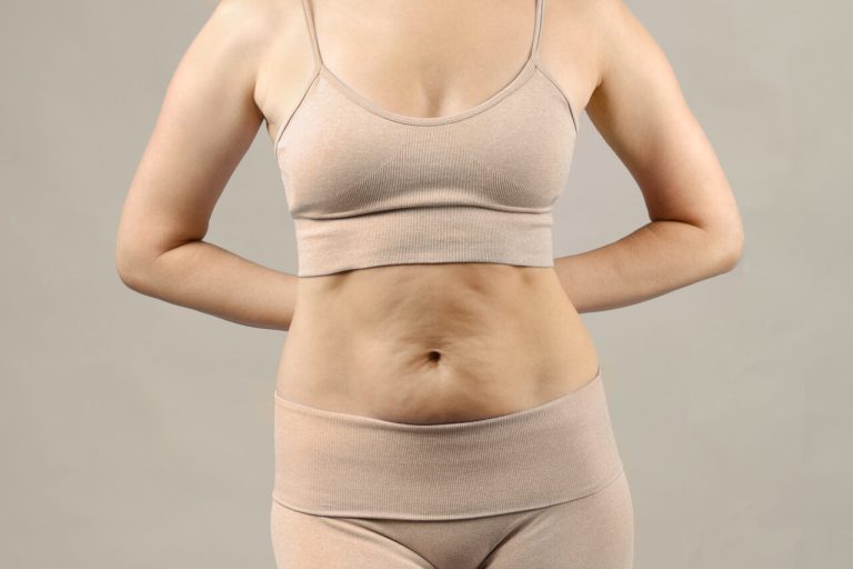 Quer eliminar a pochete? Miniabdominoplastia é alternativa segura com cicatriz discreta