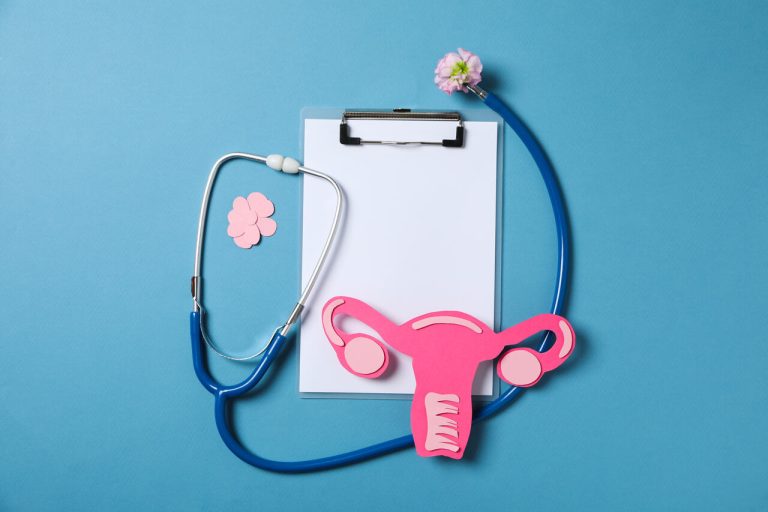 Quando operar miomas e pólipos uterinos? Saiba o que considerar