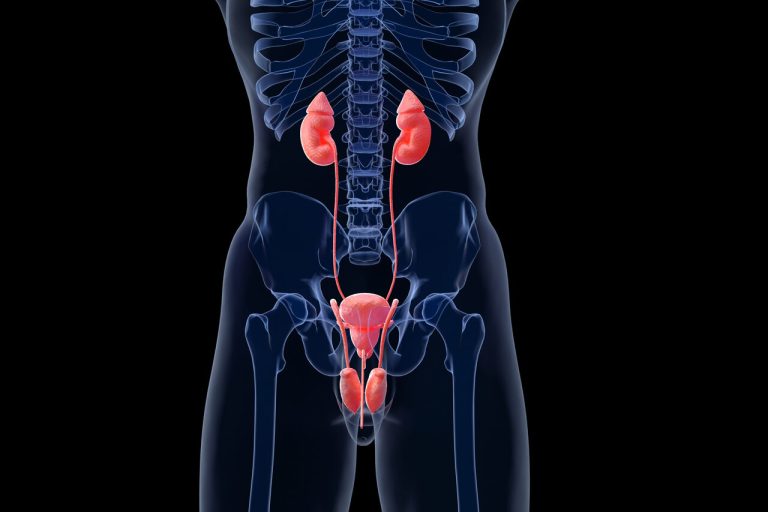 Tumores no sistema urinário: como identificar e evitar