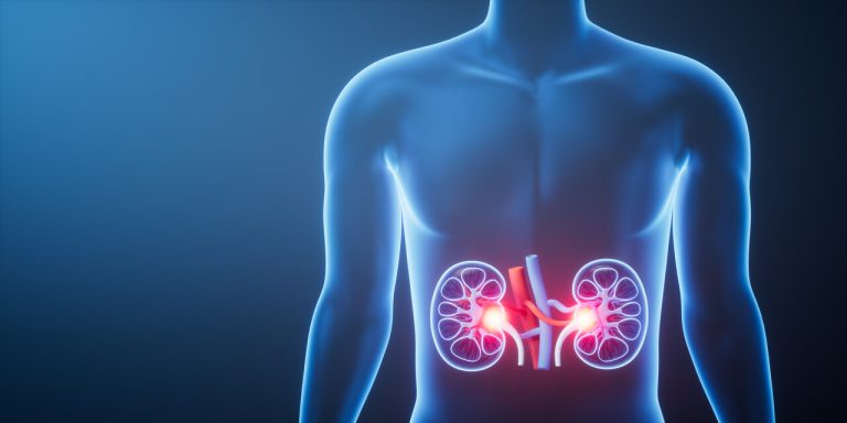 Dor nas costas e sangue na urina? Pode ser hidronefrose