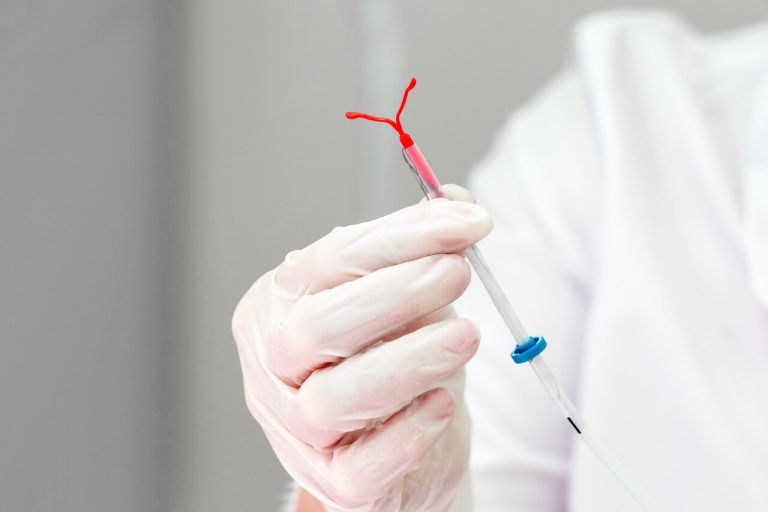 Gravidez com DIU? Veja quando isso pode acontecer e como prevenir