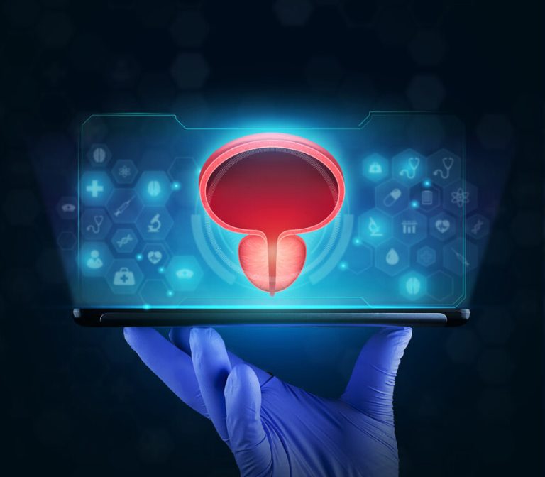 Cirurgia com laser de holmium se destaca no combate à hiperplasia prostática