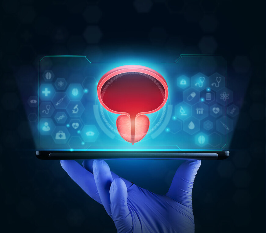 Qual a melhor opção de cirurgia a laser para próstatas de grande volume
