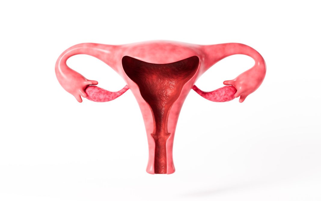 5 vilões da sua rotina que pioram a endometriose